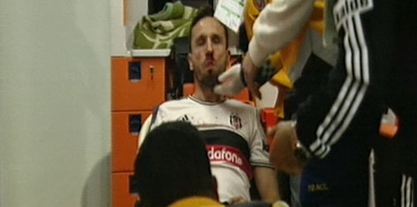 15-05/03/tomas-sivok-hastanelik-oldu-5593350