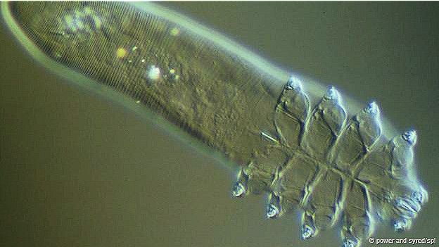 15-05/08/150508141243_demodex_624x351_bbc_nocredit