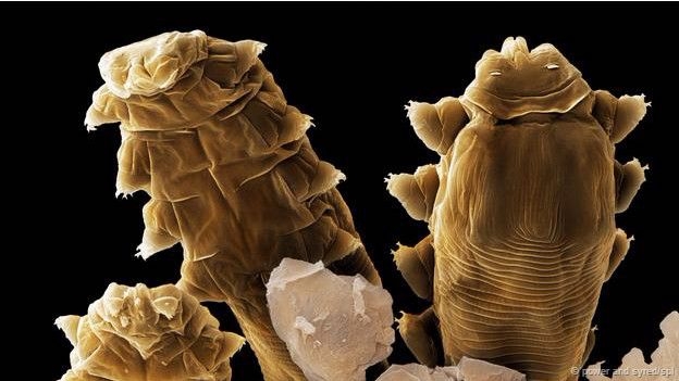 15-05/08/150508141308_demodex_624x351_bbc_nocredit