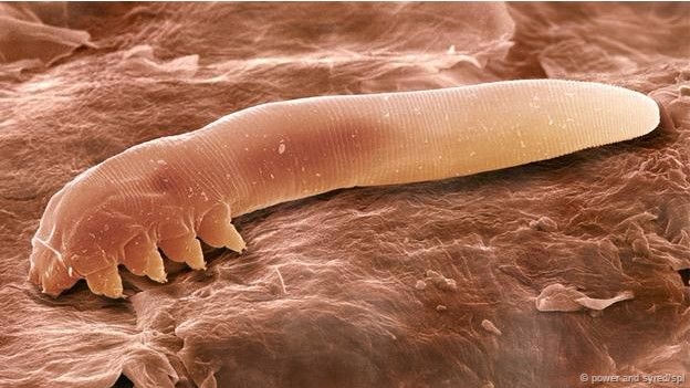 15-05/08/150508141331_demodex_624x351_bbc_nocredit