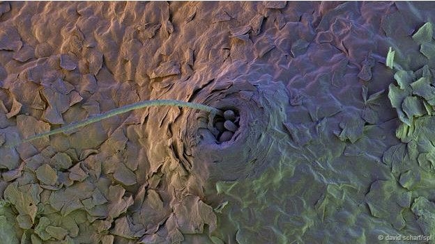 15-05/08/150508141437_demodex_624x351_bbc_nocredit