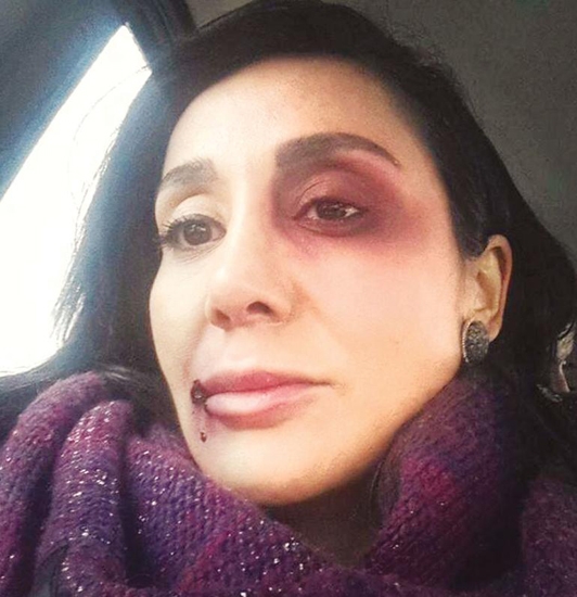 15-11/10/saruhan-hurel-dayak1