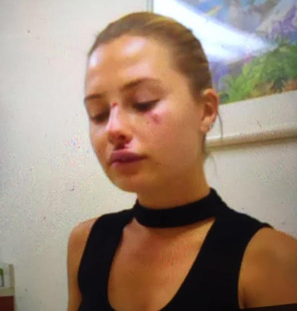 16-05/22/kaza-geciren-serdar-ortac-in-esinin-yuzu-cizik-8460104_5376_m