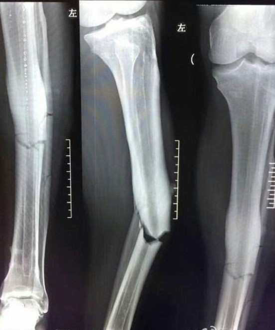 16-07/19/2016-07-19_164939