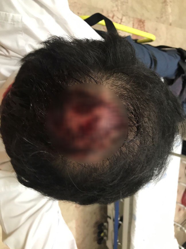 17-04/22/iceri-1492851888