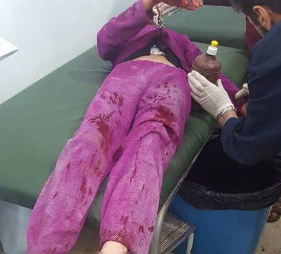 17-06/18/a2945c348a853eb85a7442da3db4b07f-1497788057