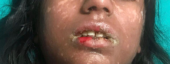 18-01/28/antalya-copy