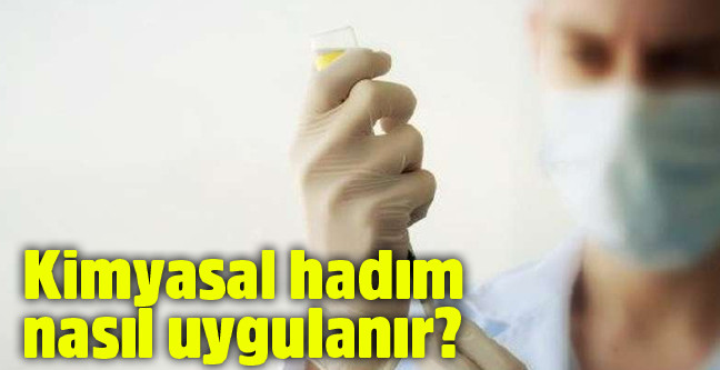 18-02/20/kimyasal-hadim-nasil-uygulanir