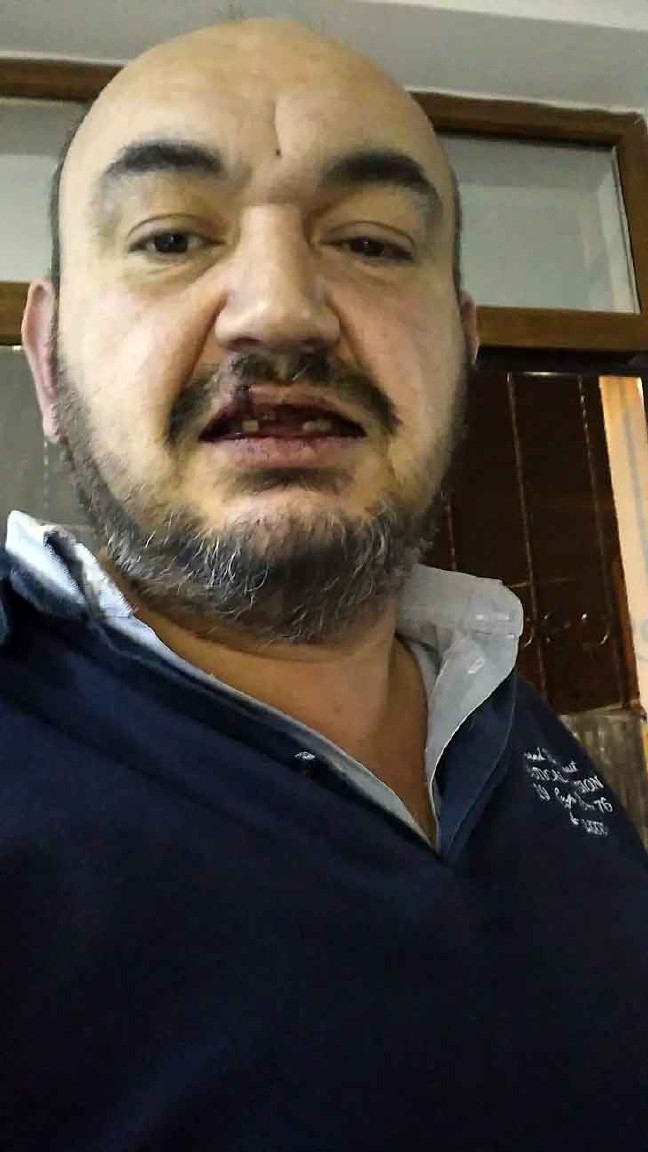 18-03/19/aw337133_01