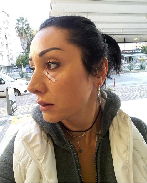 18-04/30/-patatesi-degistir-dedi-garson-bicagi-yuzune-firlatti-11363446