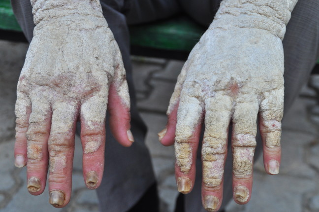 18-07/04/20180704_2_31276419_35316290