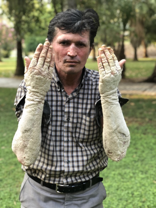 18-07/04/20180704_2_31276419_35316295-1