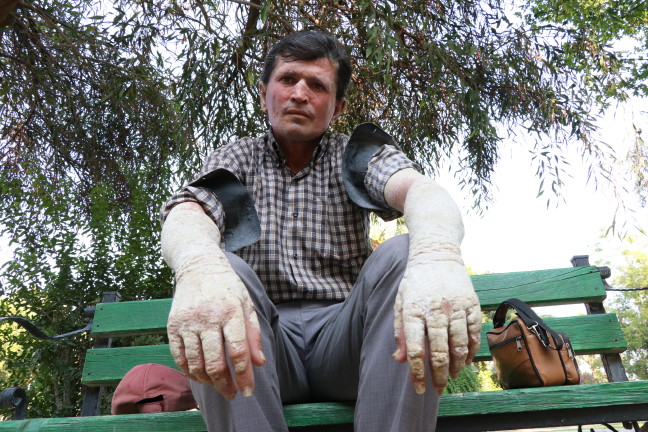 18-07/04/20180704_2_31276419_35316296