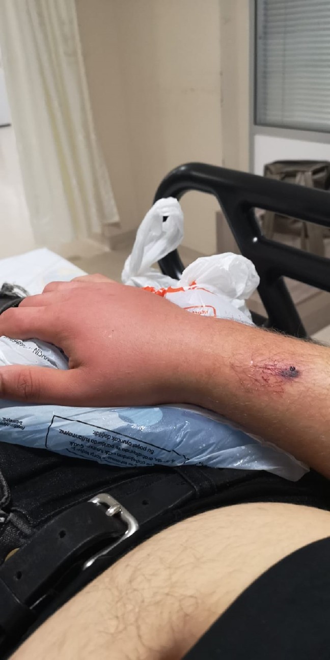 18-07/16/illuzyonist-arefi-kobra-yilani-isirdi_9835_dhaphoto12