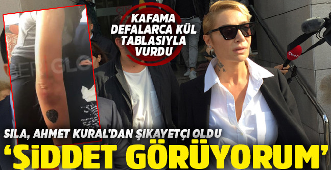 18-11/01/sila-ahmet-kural-siddet-1541083700