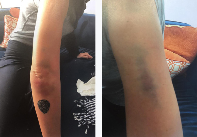 18-11/05/ahmet-kural-sila-gencoglu-1