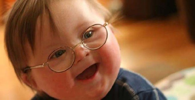 19-03/21/21-mart-down-sendromu