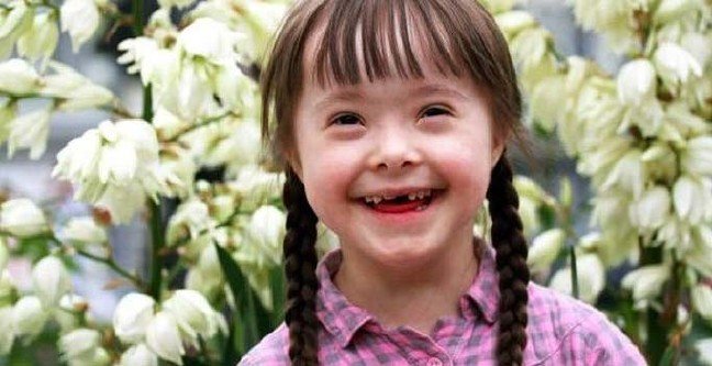 19-03/21/down-sendromu