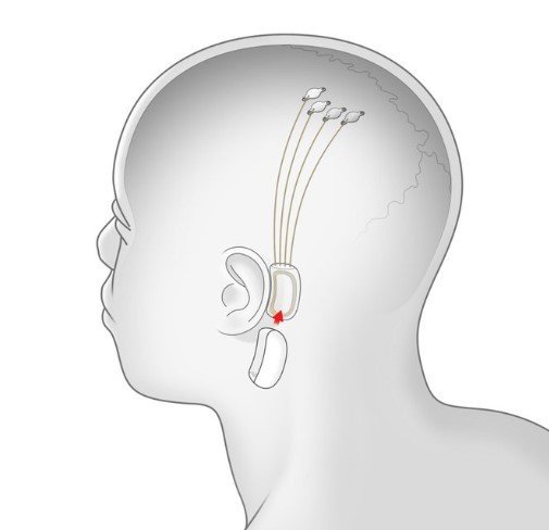 19-07/17/beyin-1563372394