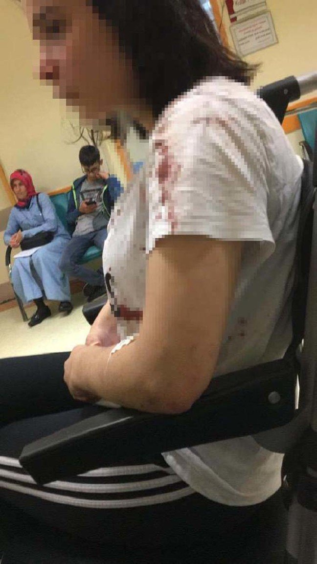 19-07/29/rizedeki-saldirida-yaralanan-rabia-dhaya-konustu-bogarak-oldurucekti_1516_dhaphoto18