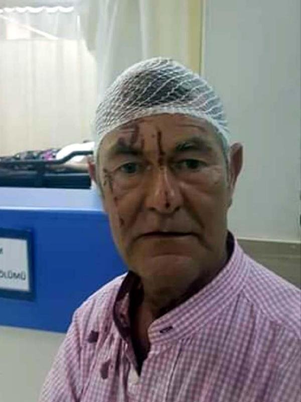 19-08/03/732f4735283b1db8247ce964c43e9ecc-1564820437