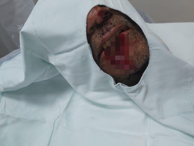 19-09/19/4033028be7c7389866076694d6a3422b-1568878111