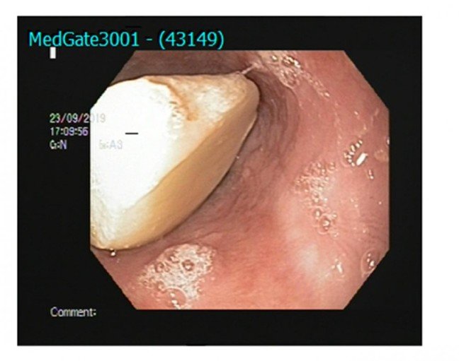 19-10/01/6bb506598a14985ddddd41362d64e96c-1569920497