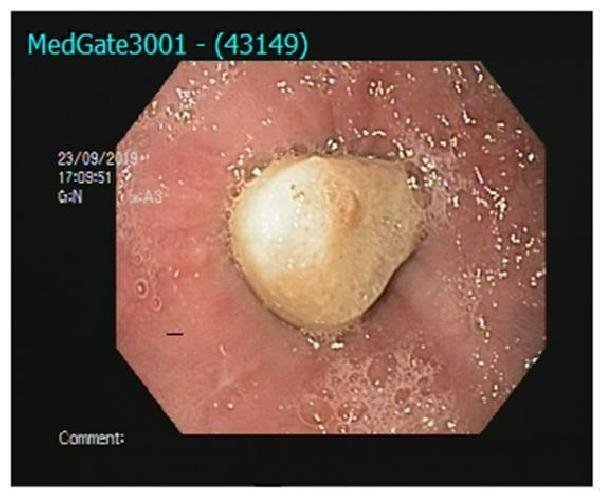 19-10/01/f226bad331cc45f4cb162dd10142db18-1569920505