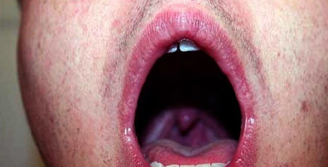 19-11/08/bogaz-agrisijpgg