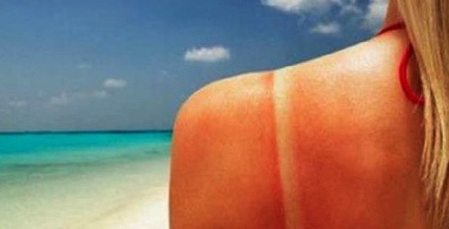 19-11/13/gunes-yanigijpgg