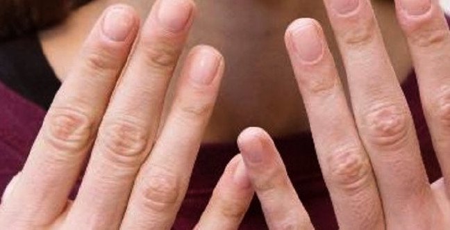 19-11/20/demir-eksikligijpgg