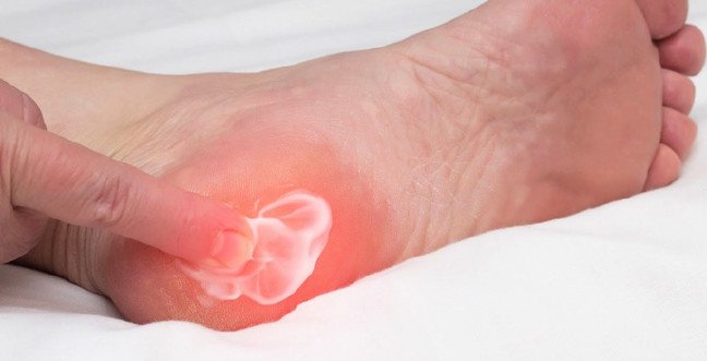 19-11/27/topuk-dikenijpgg