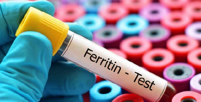 19-12/02/ferittin-1575271476