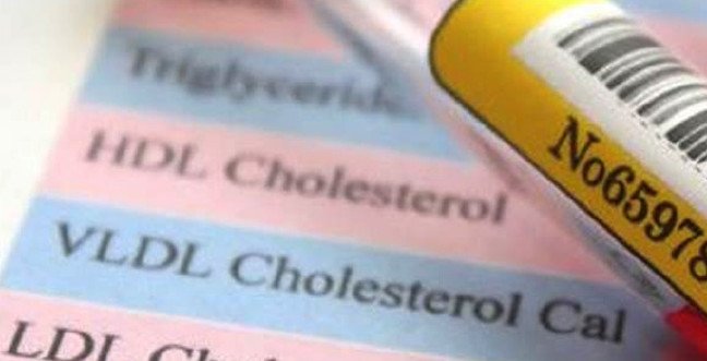 19-12/05/hdl-kolesteroljpgg