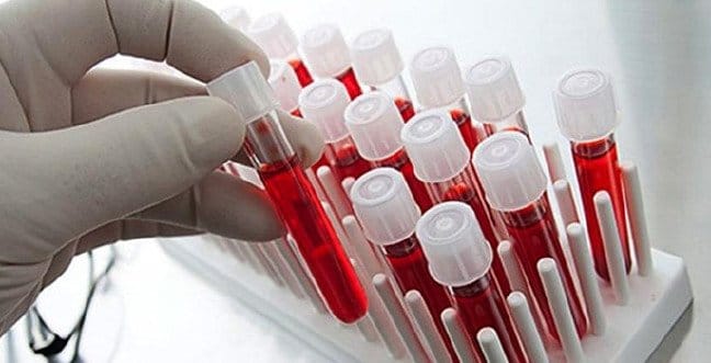 19-12/06/wbc-yuksekligi-dusuklugujpgg