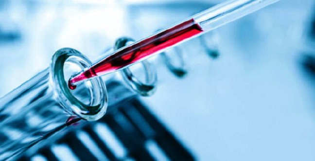 19-12/07/hct-nedirjpgg