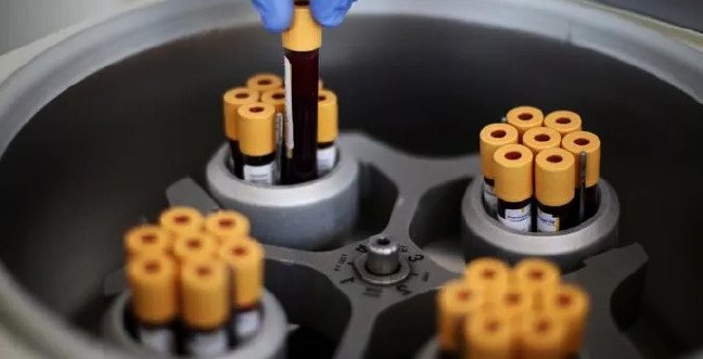 19-12/07/mcv-nedir-mcv-dusuklugu-ve-yuksekligi-anlami