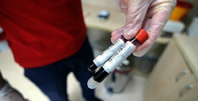 19-12/07/mpv-nedir-mpv-yuksekligi-ve-dusuklugu-anlamijpgg