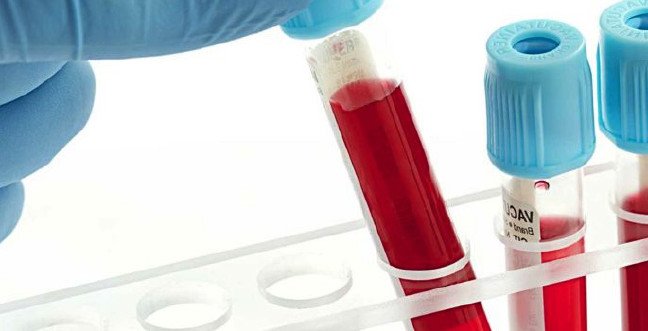 19-12/07/plt-yuksekligi-ve-dusuklugu-anlami-plt-nedirjpgg