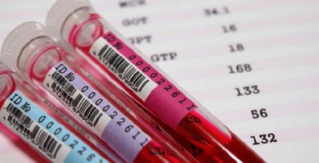 19-12/07/rdw-dusuklugu-ve-yuksekliginin-ne-anlami-rdw-nedirjpgg