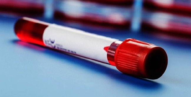 19-12/09/eos-nedirjpgg