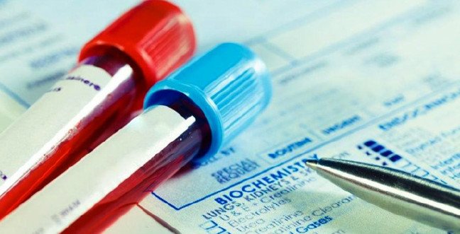 19-12/10/alt-nedir-alt-yuksekligi-ve-dusuklugu-neden-olurjpgg