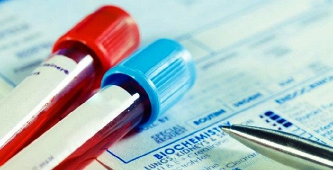 19-12/10/ast-nedir-ast-dusuklugu-ve-yuksekligi-ne-anlama-gelirjpgg