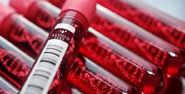 19-12/11/kreatinin-nedir-kreatinin-yuksekligi-anlami