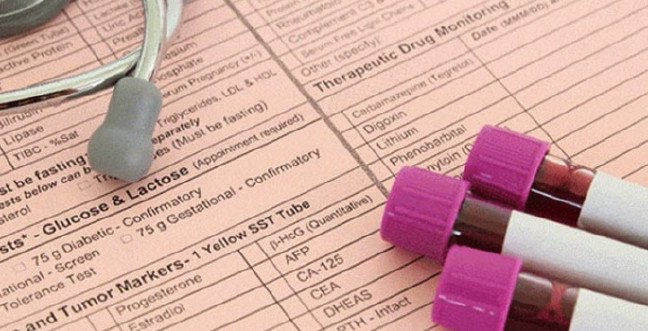 19-12/11/trigliseridjpgg-1576073594