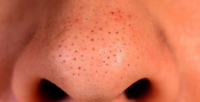 19-12/16/siyah-noktalarjpgg