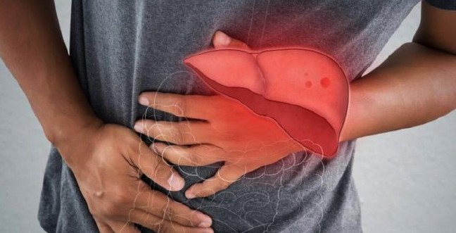 19-12/17/karaciger-yaglanmasijpgg