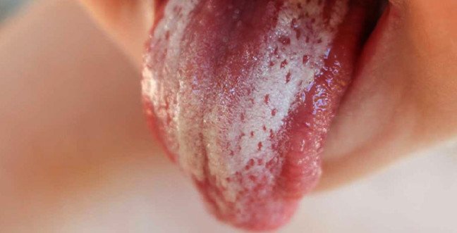 19-12/17/pamukcukjpggg